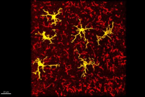 Microglies (en jaune, cellules immunitaires du cerveau), activées par la nature pro-inflammatoire d’un régime enrichi en huile de tournesol (microscopie à fluorescence).