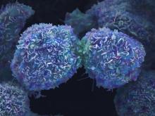 Exosomes tumoraux circulants : vers une nouvelle génération de biopsie liquide ?