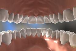 Les pathologies bucco-dentaires en soins primaires