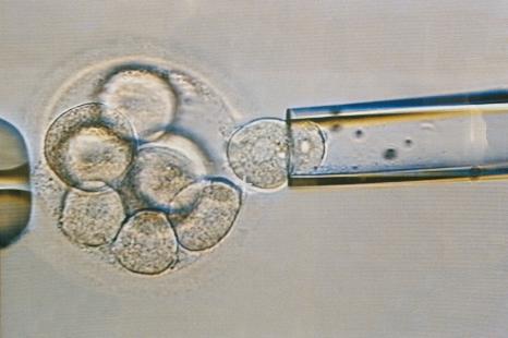 Le DPI-A permet d’éviter de transférer un embryon mal constitué