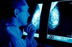 L'IA pourrait aider les radiologues dans le dépistage du cancer du sein, avance une étude suédoise