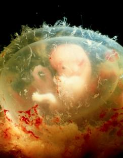 L'embryon est une cible vulnérable, ces substances étant capables de traverser la barrière placentaire