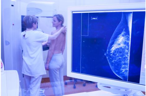 Octobre rose : Curie mise sur les origines pour éclaircir l'avenir des cancers du sein