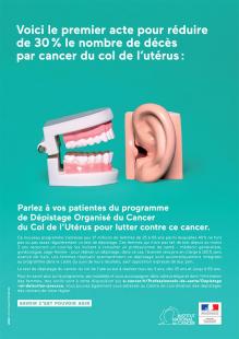 Campagne De Depistage Du Cancer Du Col Mode D Emploi Le Quotidien Du Medecin
