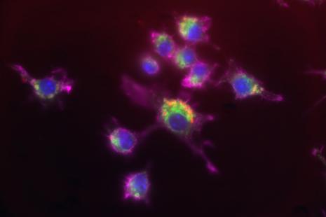 Bactéries Yersinia pestis (en rouge) observées au microscope dans des macrophages humains. En mauve : cytosquelette d'actine, en vert: compartiments endocytaires, en bleu: noyau/ADN.